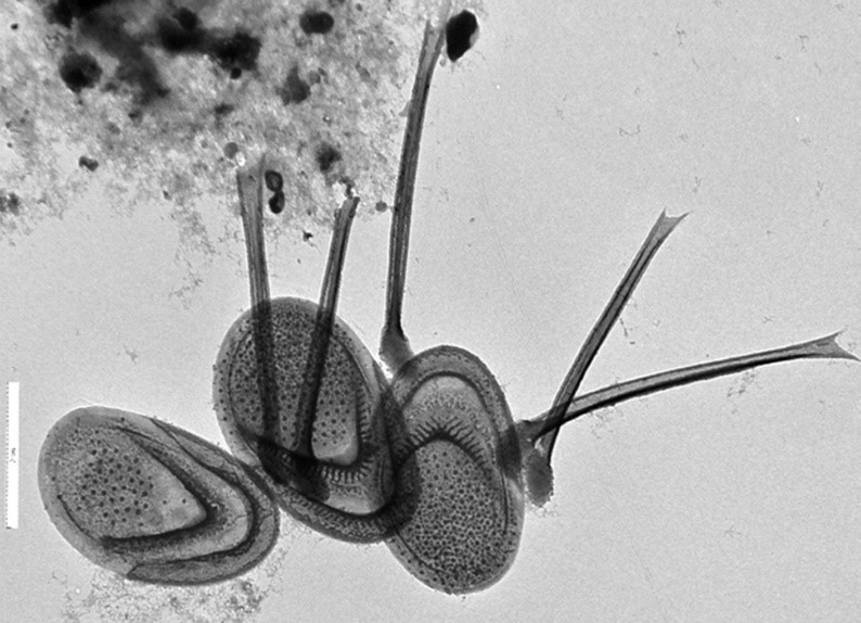 Loài tảo mới Mallomonas doanii sp. nov đặc hữu của Việt Nam thuộc chi Mallomonas, phân ngành Ouradiotae (Chrysophyceae, Synurales)